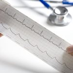 When Should You See a Cardiologist?